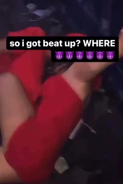 Belabands was fighting